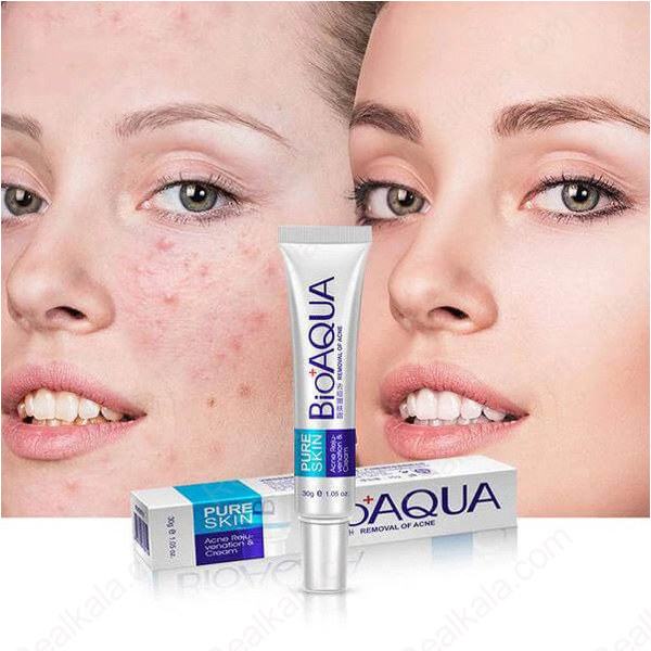 کرم ضد جوش بیوآکوا مدل Pure Skin Acne Removal Cream مناسب پوست مستعد آکنه