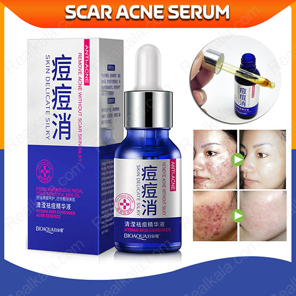 سرم ضد جای جوش بیوآکوا Scar Acne Serum حجم 30 میل همراه با جعبه آبی محصول