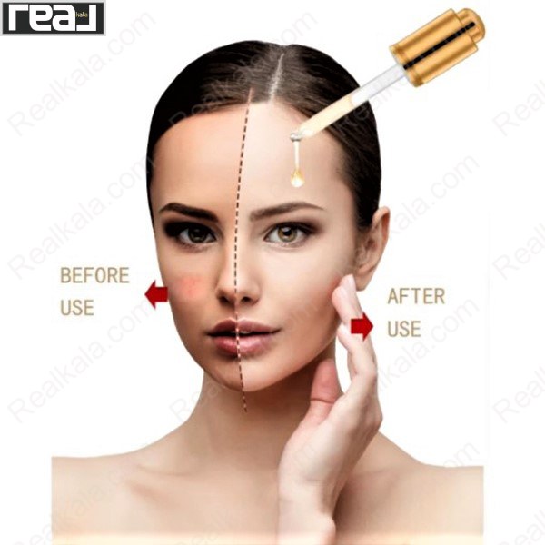 نتیجه استفاده از سرم طلای 24 عیار دکتر راشل روی صورت