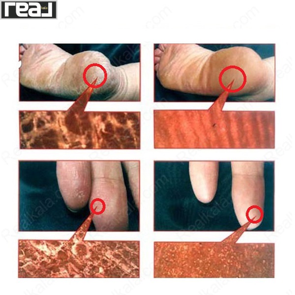 تصویر  کرم نرم کننده و مرطوب کننده یوسکین آ YuskinA Family Medical Cream 70g