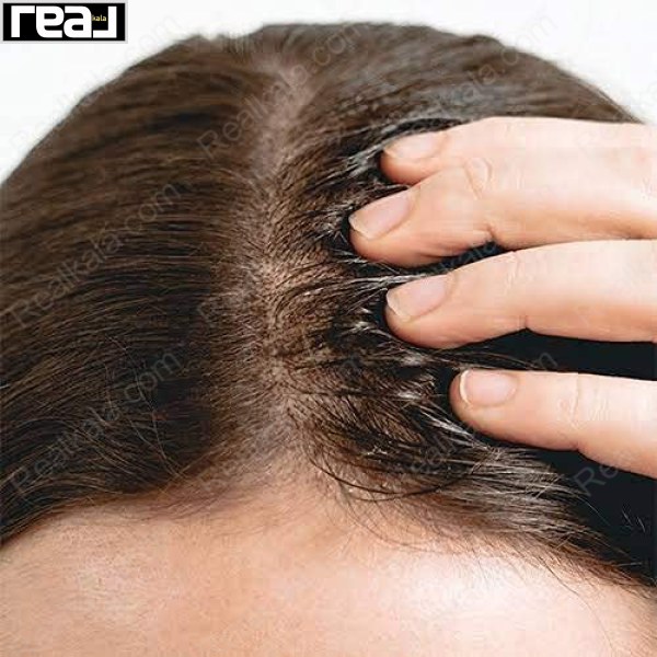 ماساژ پوست سر پس از استفاده از سرم The Ordinary Multi‑Peptide برای جذب بهتر و تقویت ریشه مو