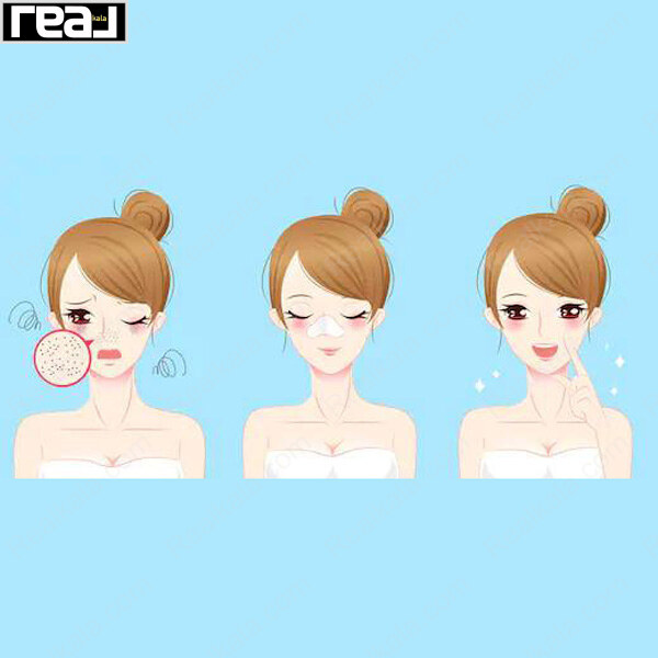 مراحل استفاده از چسب بینی لوک برای پاک سازی جوش های سرسیاه و چربی